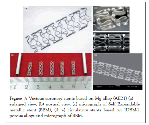 automobile-alloy