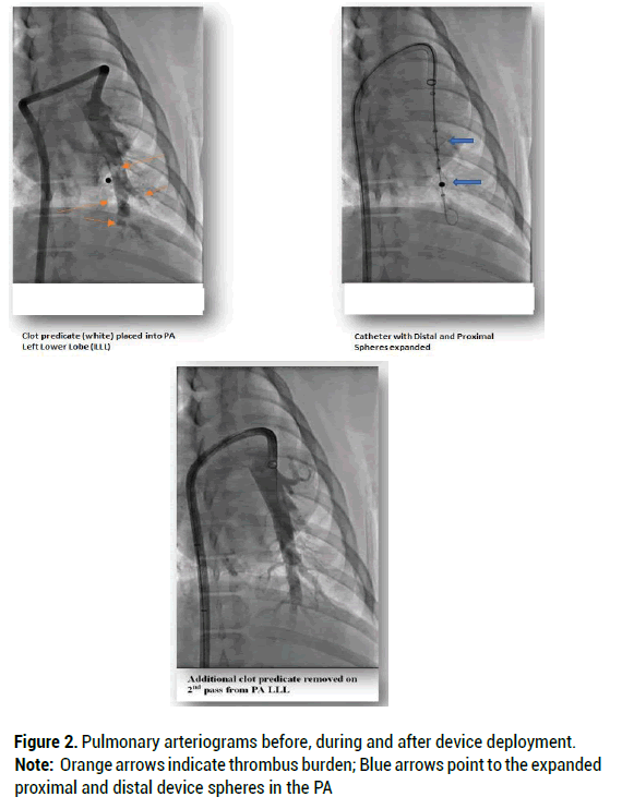 biology-arteriograms