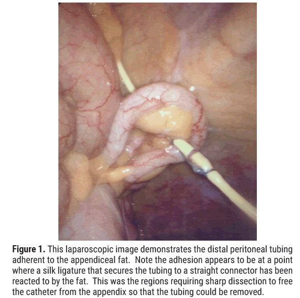 biology-laparoscopic