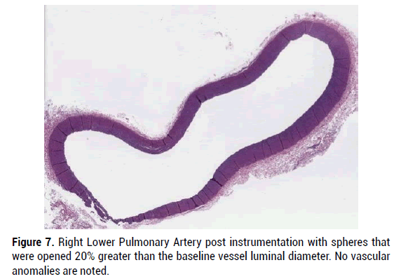 biology-pulmonary