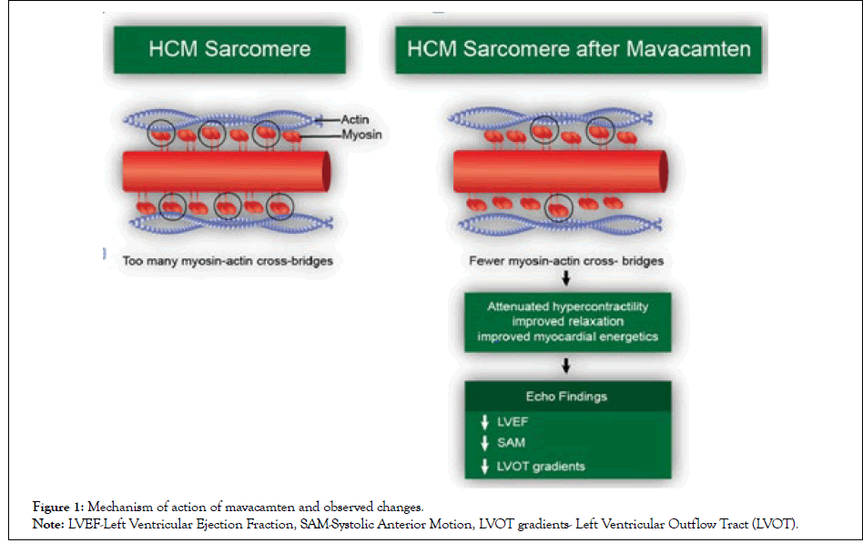 cardiology-mechanism