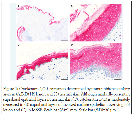 Cytokeratin