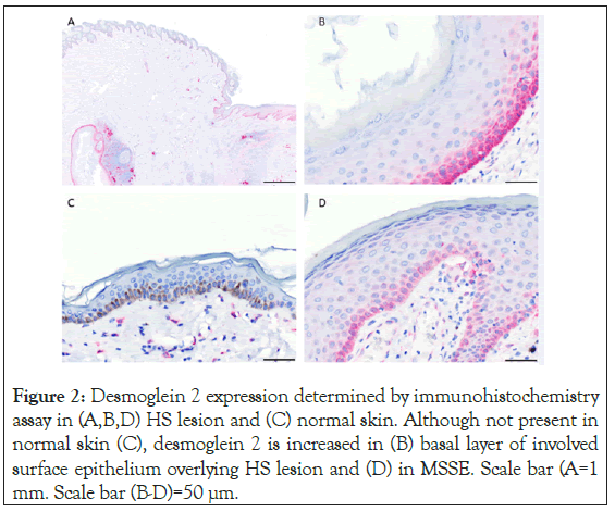 Desmoglein