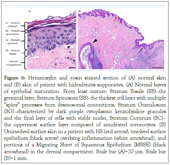 Hematoxylin