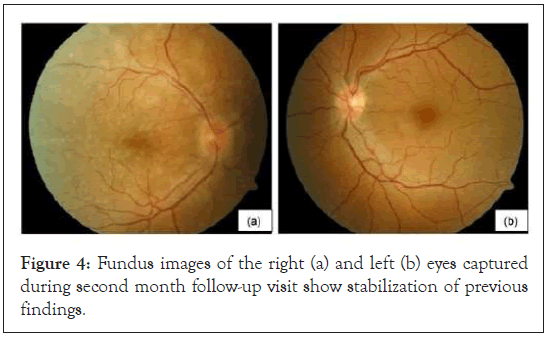 Fundus