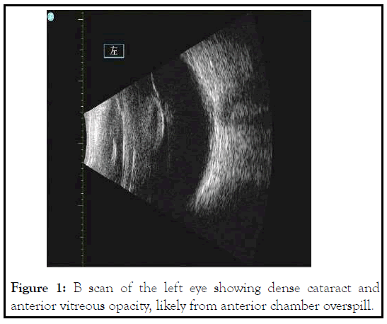 anterior