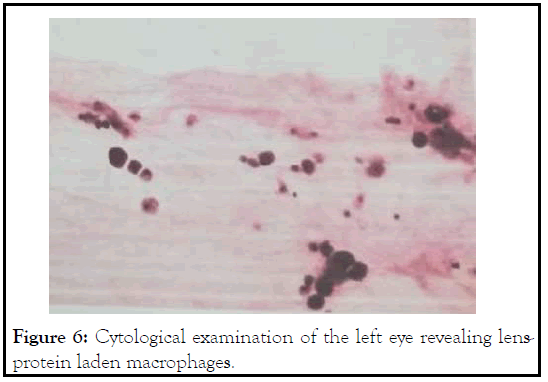 macrophages