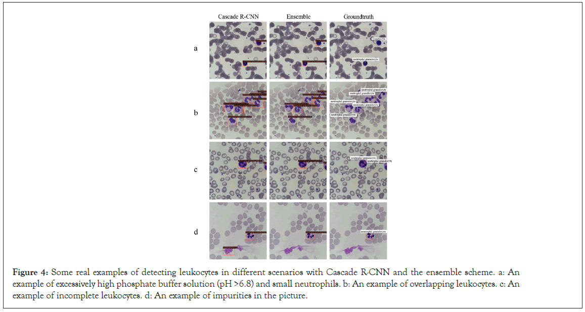 leukocytes