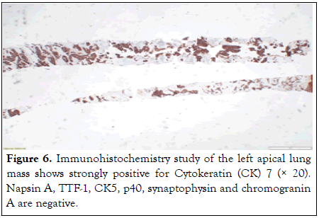 clinical-trials-lung