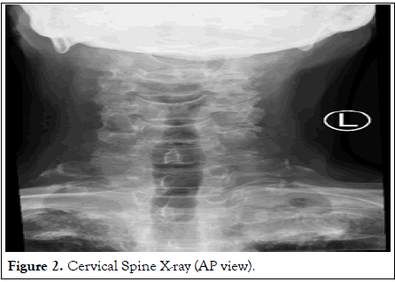 clinical-trials-spine