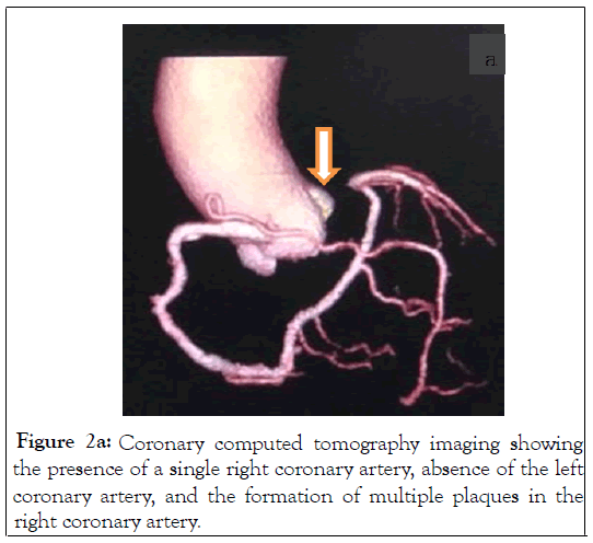 clinical-trials-tomography