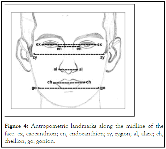 dermatology-endocanthion