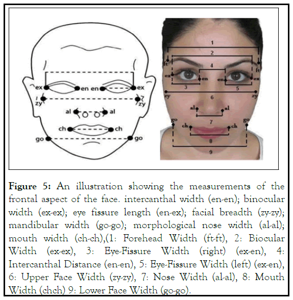 dermatology-intercanthal