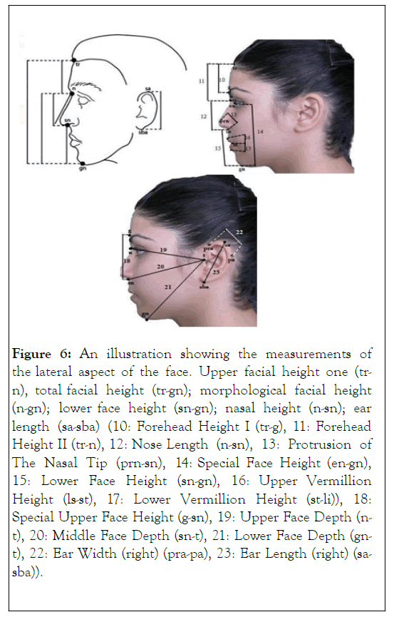 dermatology-upper-facial