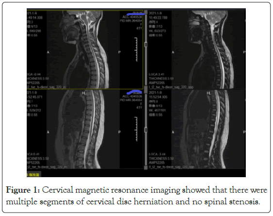 Cervical