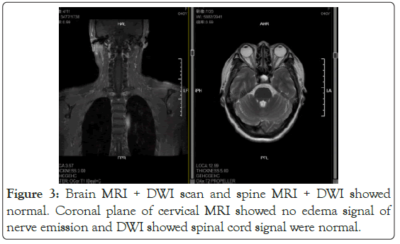 Coronal