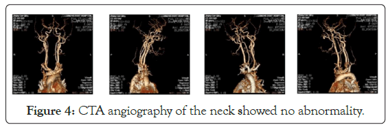 angiography