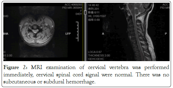 vertebra