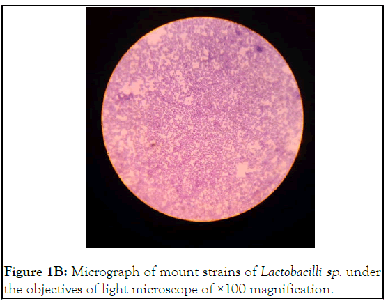 enzyme-micrograph