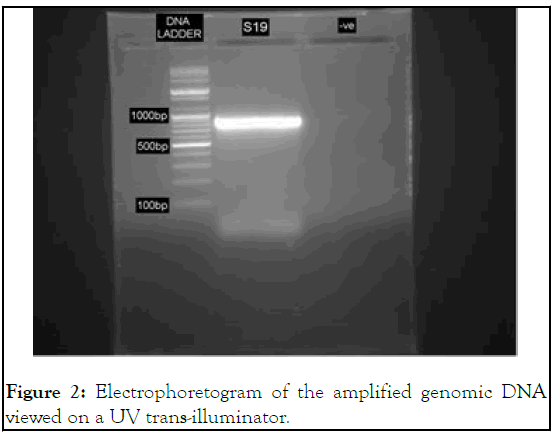 enzyme-uv