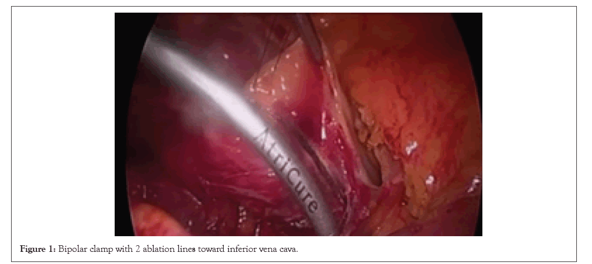 experimental-cardiology-ablation