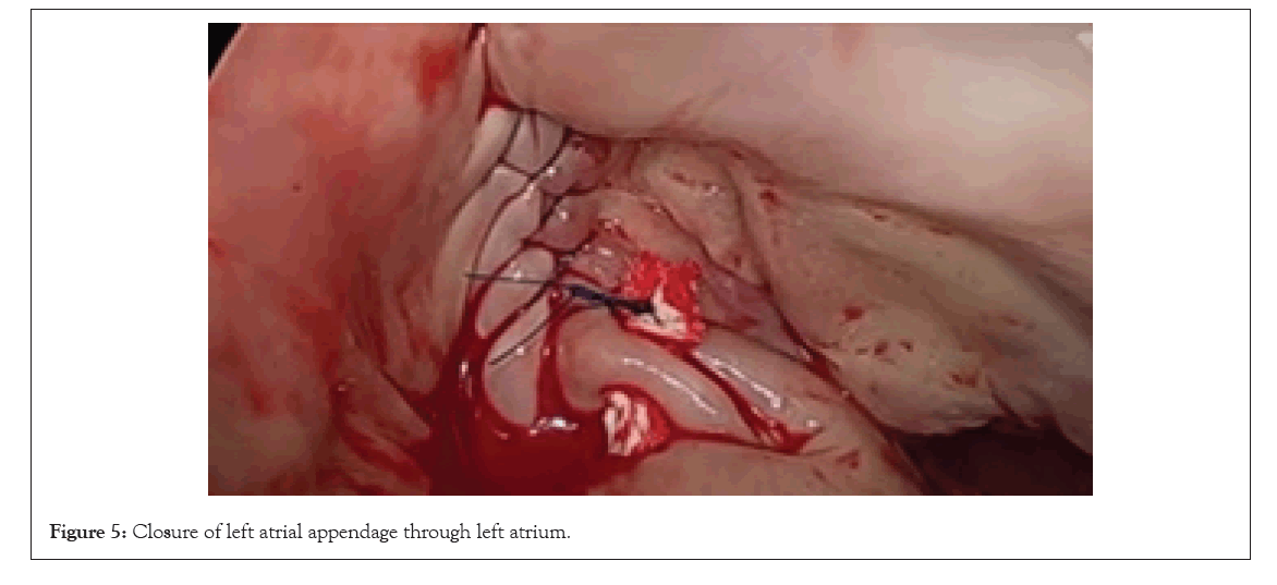 experimental-cardiology-appendage