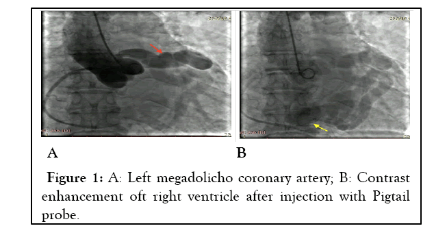 experimental-cardiology-coronary