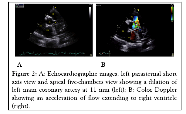 experimental-cardiology-parasternal