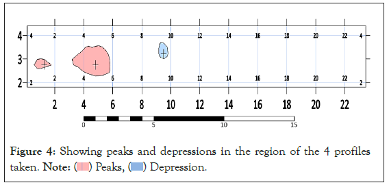 depressions