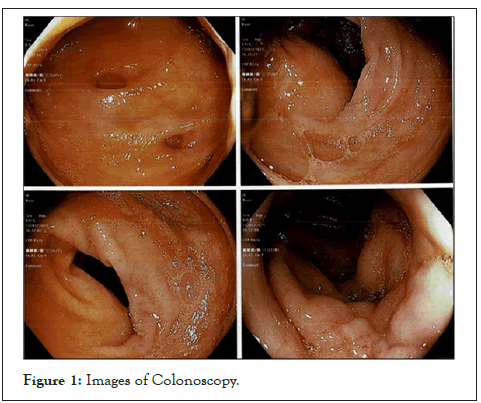 hepatology-colonoscopy