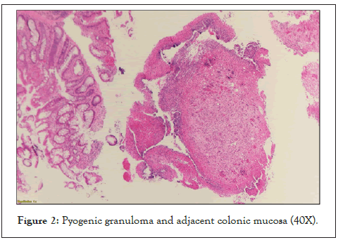 hepatology-pyogenic