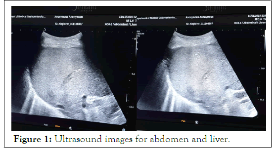 hepatology-ultrasound