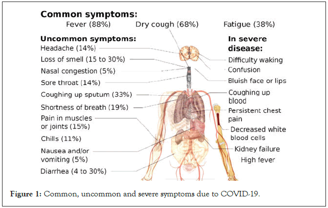 immunome-research-severe-symptoms-covid