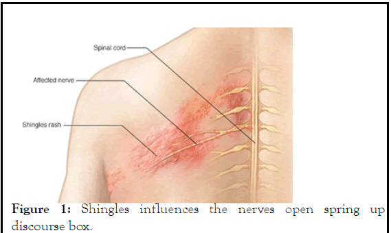 infectious-spring