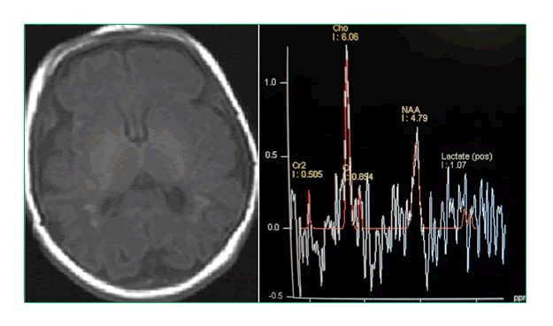 journal-research-axial