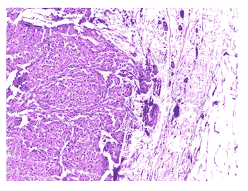 journal-research-lesion