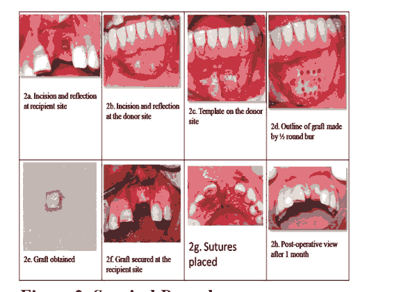 journal-research-procedure