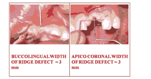 journal-research-ridge