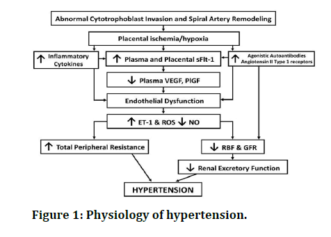 jrmds-hypertension
