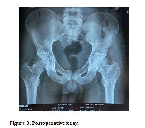 jrmds-xray