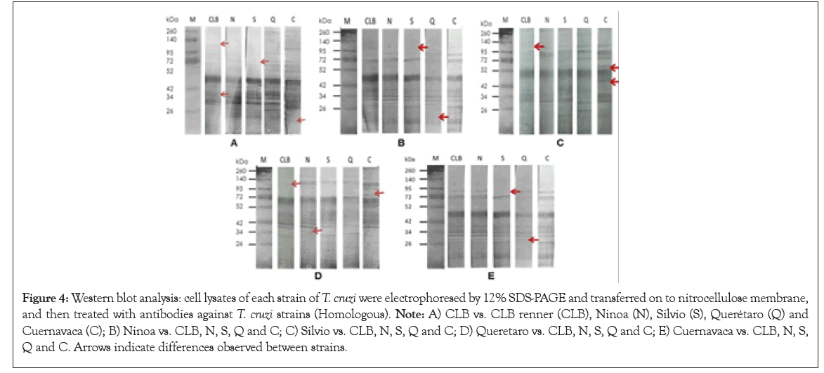 leukemia-electrophoresed