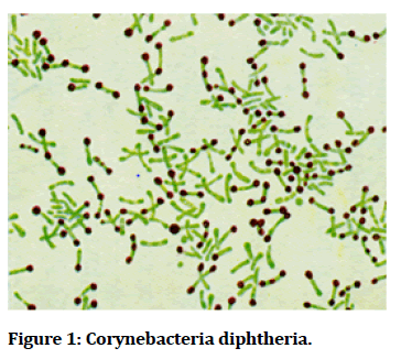 medical-dental-Corynebacteria-diphtheria