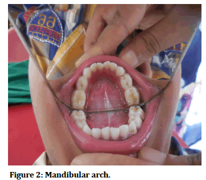 medical-dental-Mandibular