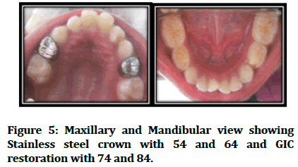 medical-dental-Mandibular