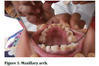 medical-dental-Maxillary