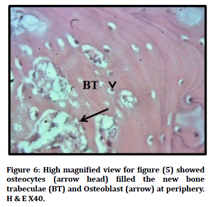 medical-dental-Osteoblast