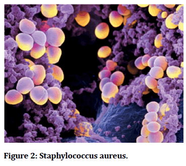 medical-dental-Staphylococcus-aureus