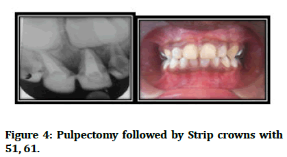 medical-dental-Strip