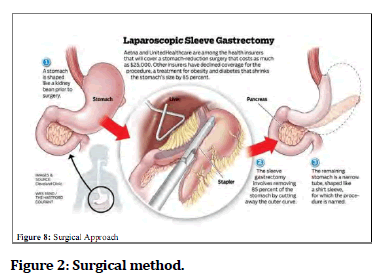 medical-dental-Surgical-method