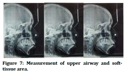 medical-dental-airway